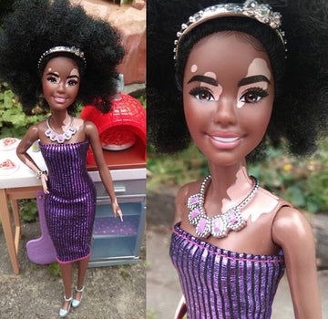 Mattel launch vitiligo Barbie!